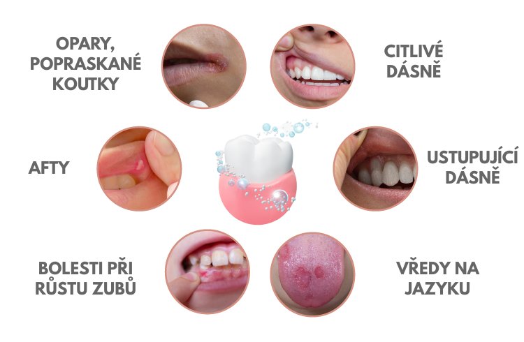 OROXID sensitiv gel pro citlivé dásně